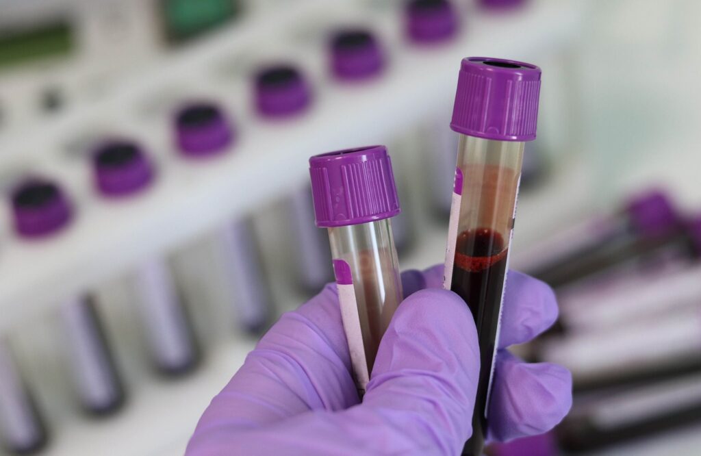 Blood tests: what are they used for?  - She